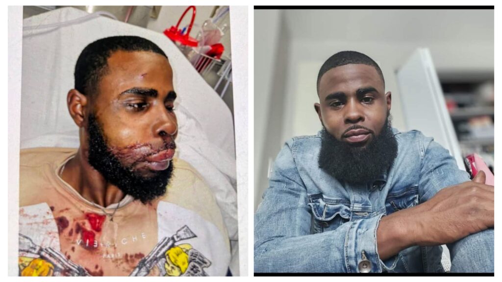 Deandre X Givhan revealed his face after GRPD officers attacked him with K9 dog in Grand Rapids