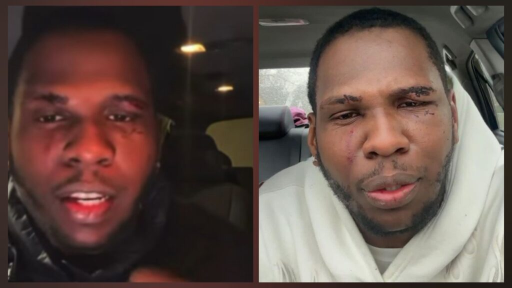 VIDEO: Ekane’s BD, Bc Smith Chris, revealed he got beat up