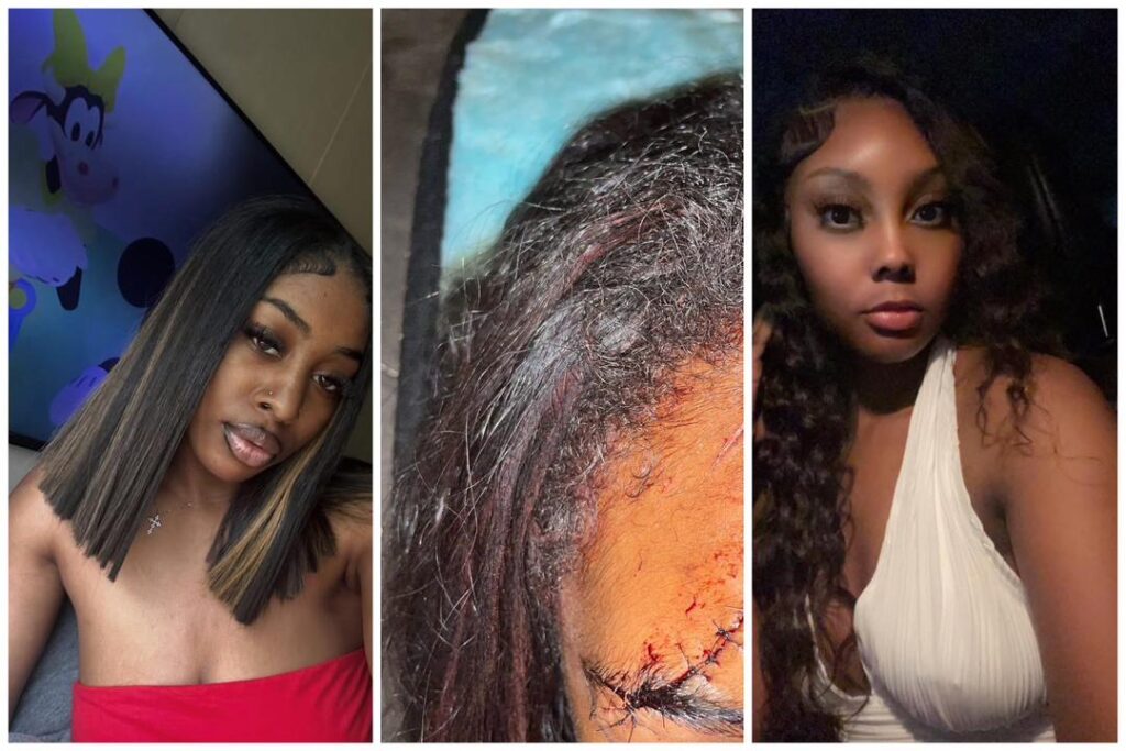 Woman, Timiah Barnes, alongside her brother, Timarrius, held Ho Pe down to cut her face over a man